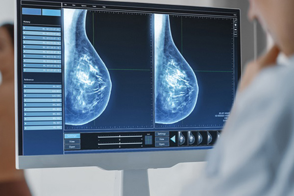 ماموگرافی، رادیولوژی و OPG دیجیتال