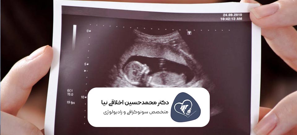 مهمترین سونوگرافی‌ های بارداری